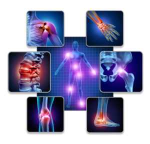 Frequently Asked Questions: Physical Therapy Treatment - Human Body Joint Pain